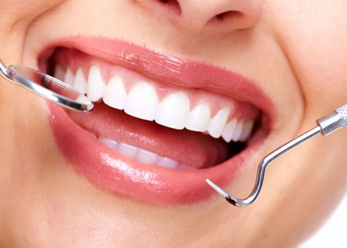 Erozije zuba – oštećenja koja nisu karijes